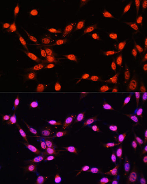 Epigenetics and Nuclear Signaling Antibodies 2 Anti-KLF2 Antibody CAB16480