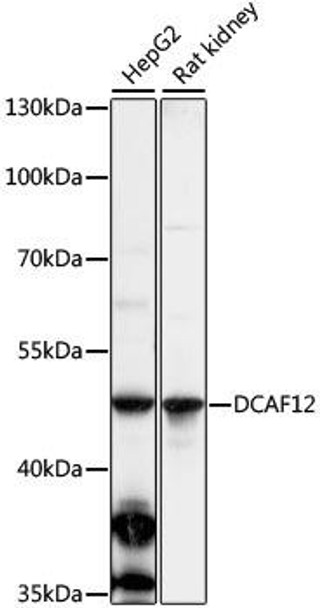 Signal Transduction Antibodies 2 Anti-DCAF12 Antibody CAB16510