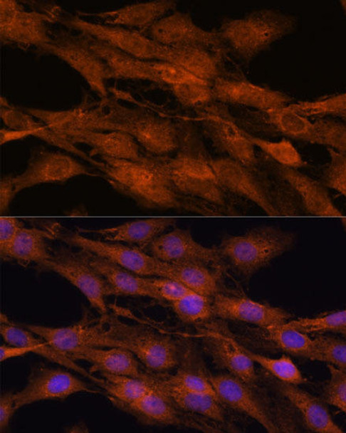 Epigenetics and Nuclear Signaling Antibodies 2 Anti-COMMD5 Antibody CAB16518