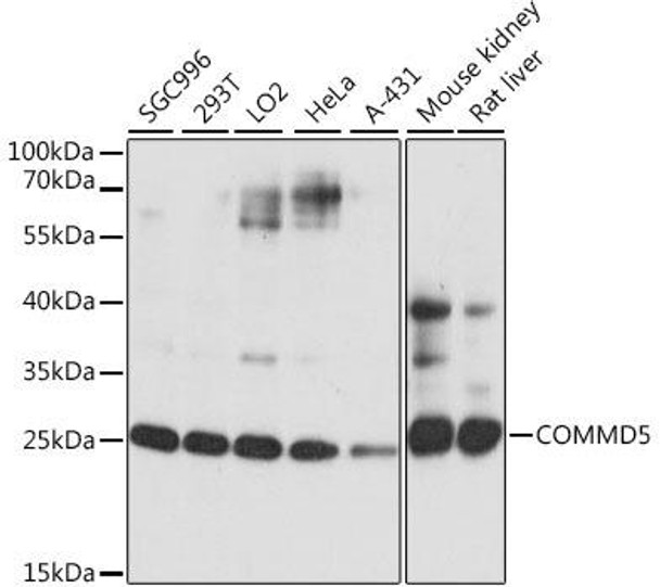 Epigenetics and Nuclear Signaling Antibodies 2 Anti-COMMD5 Antibody CAB16518