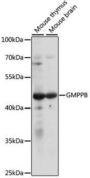 Signal Transduction Antibodies 2 Anti-GMPPB Antibody CAB16520