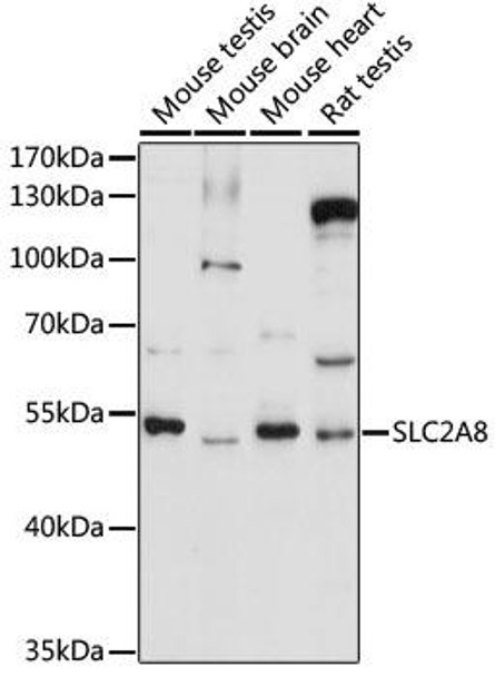 Signal Transduction Antibodies 2 Anti-SLC2A8 Antibody CAB16521