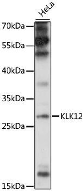 Cell Biology Antibodies 7 Anti-KLK12 Antibody CAB16523