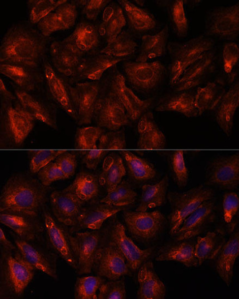 Developmental Biology Anti-ITSN2 Antibody CAB16525