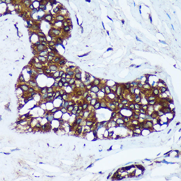 Cell Biology Antibodies 7 Anti-MRPL30 Antibody CAB16529