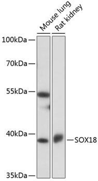 Epigenetics and Nuclear Signaling Antibodies 2 Anti-SOX18 Antibody CAB16536