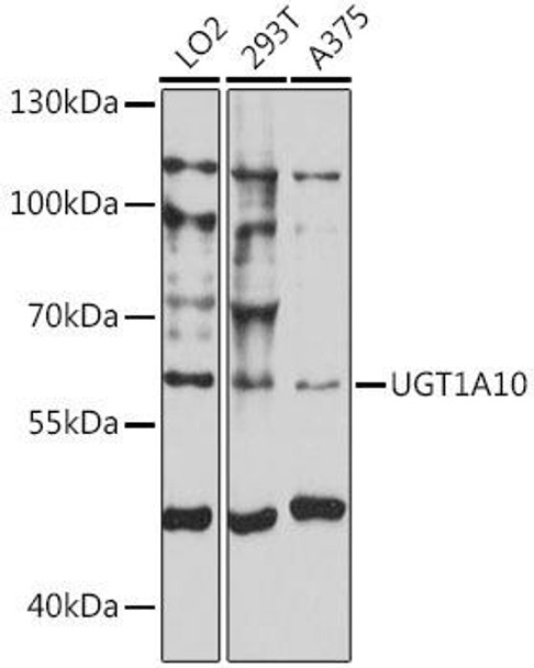 Cell Biology Antibodies 7 Anti-UGT1A10 Antibody CAB16537