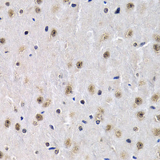 Cell Biology Antibodies 7 Anti-PTHLH Antibody CAB1654