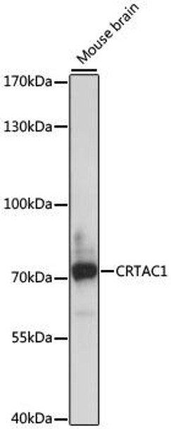 Cell Biology Antibodies 7 Anti-CRTAC1 Antibody CAB16541