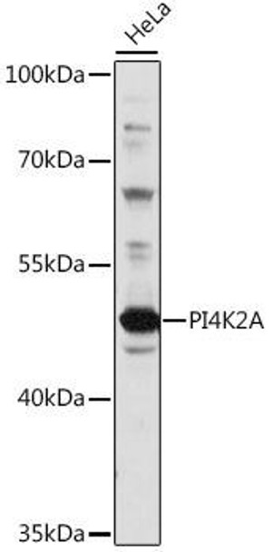 Cell Biology Antibodies 7 Anti-PI4K2A Antibody CAB16546