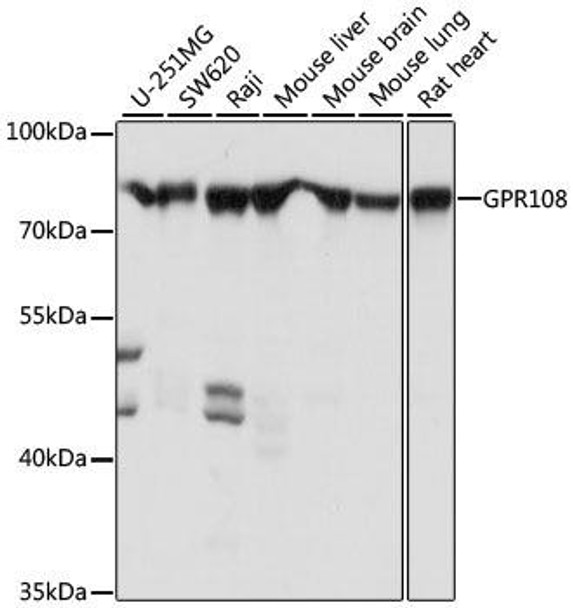 Cell Biology Antibodies 7 Anti-GPR108 Antibody CAB16554
