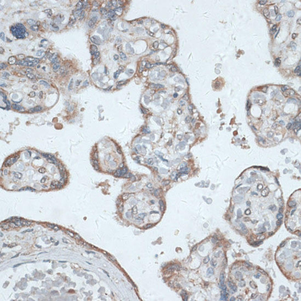 Signal Transduction Antibodies 2 Anti-PMEPA1 Antibody CAB16555