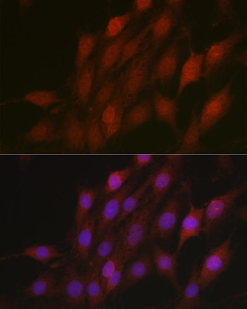 Cell Biology Antibodies 7 Anti-Beta-TRCP Antibody CAB1656