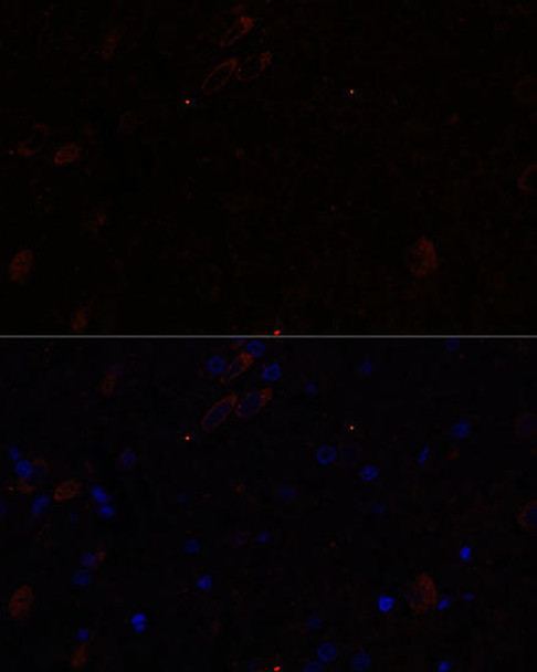 Cell Biology Antibodies 7 Anti-KIF17 Antibody CAB16562