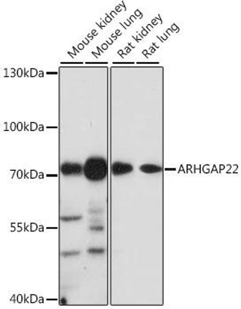 Cardiovascular Antibodies Anti-ARHGAP22 Antibody CAB16566