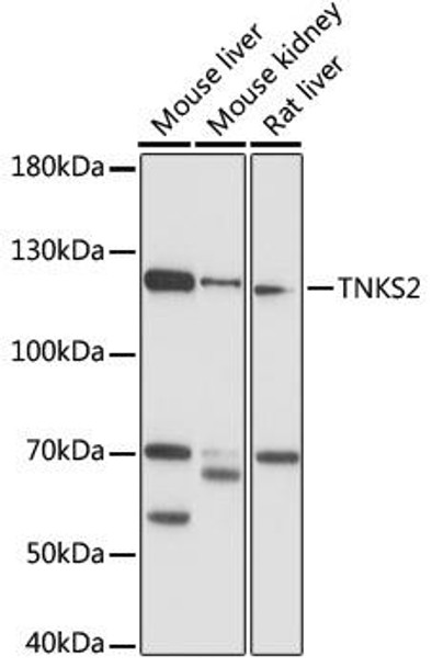 Metabolism Antibodies 2 Anti-TNKS2 Antibody CAB16575