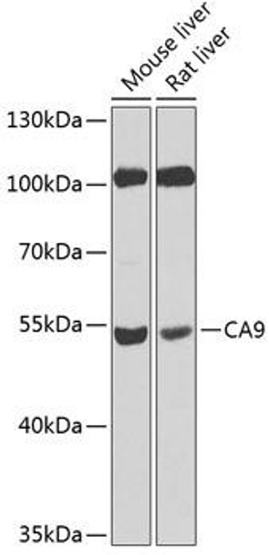 Cell Biology Antibodies 7 Anti-CA9 Antibody CAB1658