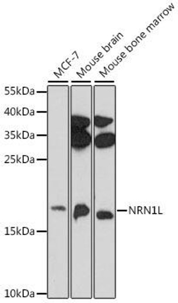 Cell Biology Antibodies 7 Anti-NRN1L Antibody CAB16594