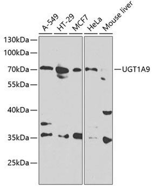 Cell Biology Antibodies 7 Anti-UGT1A9 Antibody CAB1661