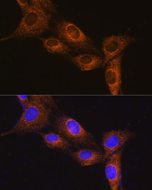 Cell Biology Antibodies 7 Anti-NPB Antibody CAB16612