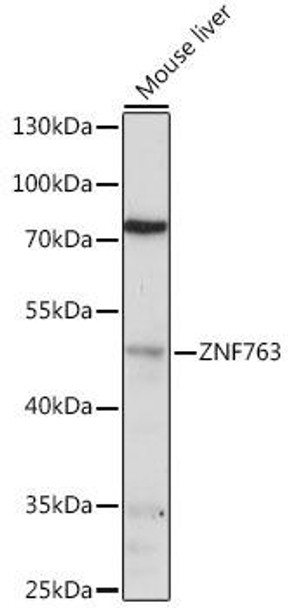 Epigenetics and Nuclear Signaling Antibodies 3 Anti-ZNF763 Antibody CAB16615