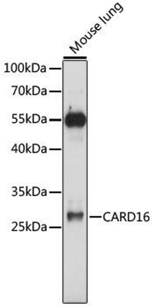 Cell Biology Antibodies 7 Anti-CARD16 Antibody CAB16624
