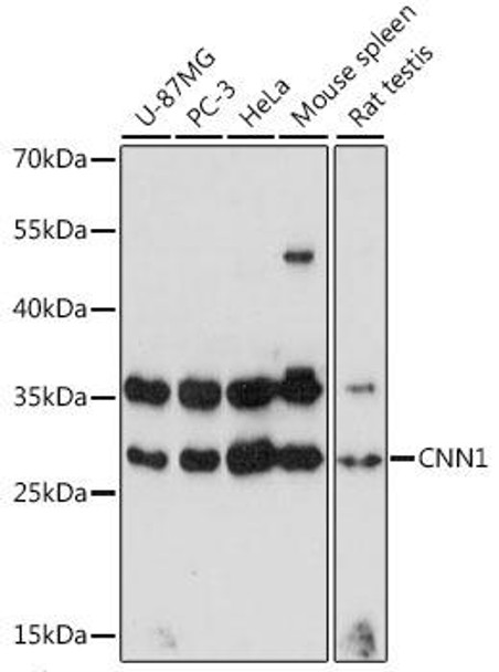 Cell Biology Antibodies 7 Anti-CNN1 Antibody CAB16638