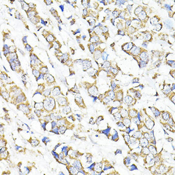 Cell Biology Antibodies 7 Anti-TGFB1 Antibody CAB16640