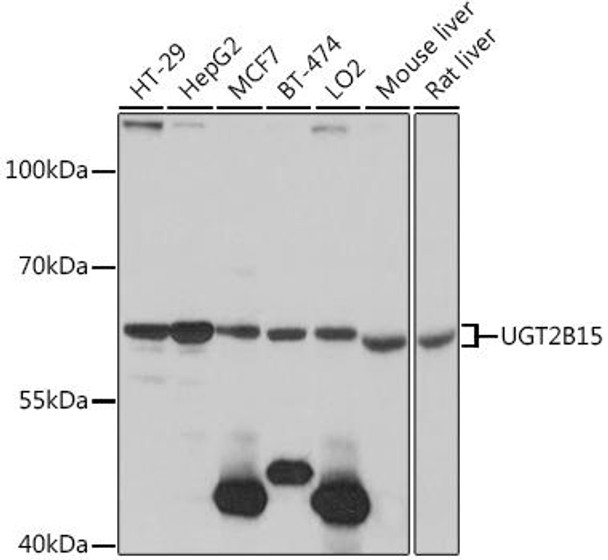 Cell Biology Antibodies 7 Anti-UGT2B15 Antibody CAB16657