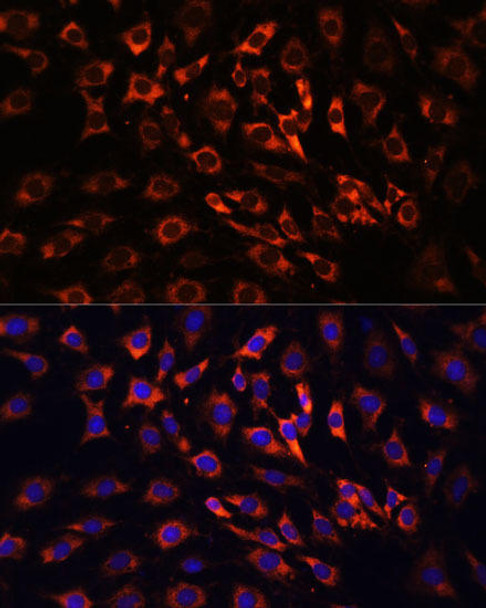 Cell Biology Antibodies 7 Anti-ERK1 / ERK2 Antibody CAB16686