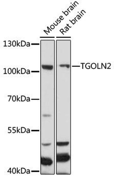 Cell Biology Antibodies 7 Anti-TGOLN2 Antibody CAB16707
