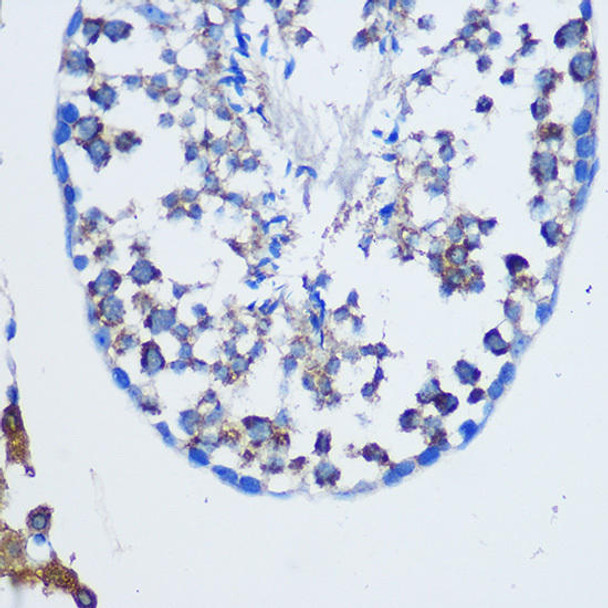 Cell Biology Antibodies 7 Anti-TGOLN2 Antibody CAB16707