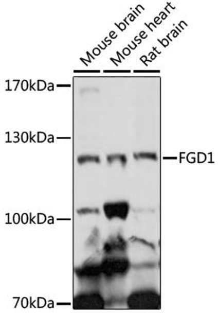 Cell Biology Antibodies 7 Anti-FGD1 Antibody CAB16709