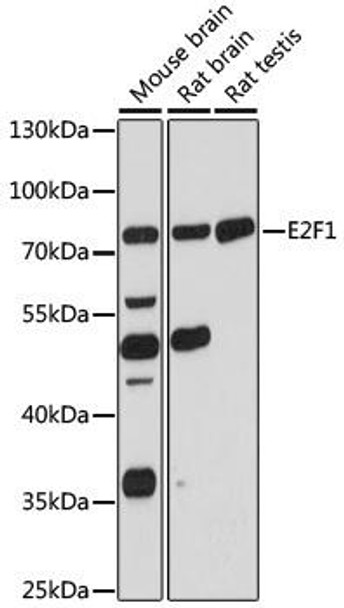 Cell Death Antibodies 1 Anti-E2F1 Antibody CAB16720