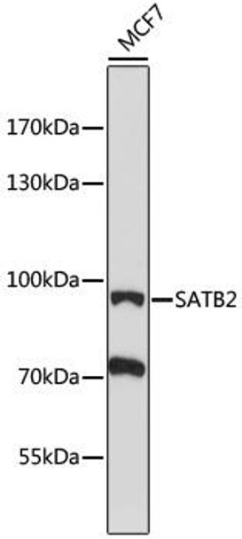 Epigenetics and Nuclear Signaling Antibodies 3 Anti-SATB2 Antibody CAB16721