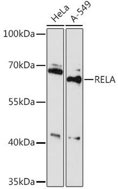 Immunology Antibodies 2 Anti-RELA Antibody CAB16728