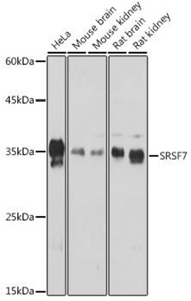 Epigenetics and Nuclear Signaling Antibodies 3 Anti-SRSF7 Antibody CAB16738