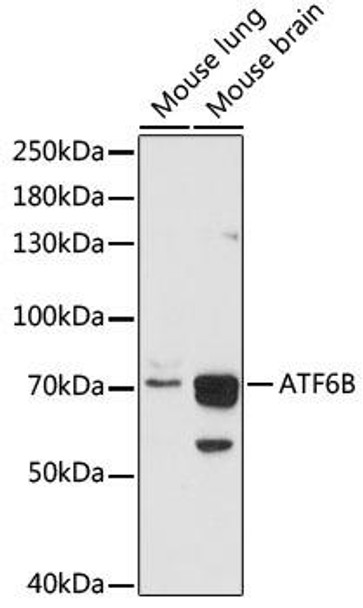 Epigenetics and Nuclear Signaling Antibodies 3 Anti-ATF6B Antibody CAB16742
