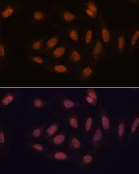 Epigenetics and Nuclear Signaling Antibodies 3 Anti-SNIP1 Antibody CAB16747