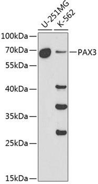 Cardiovascular Antibodies Anti-PAX3 Antibody CAB1675