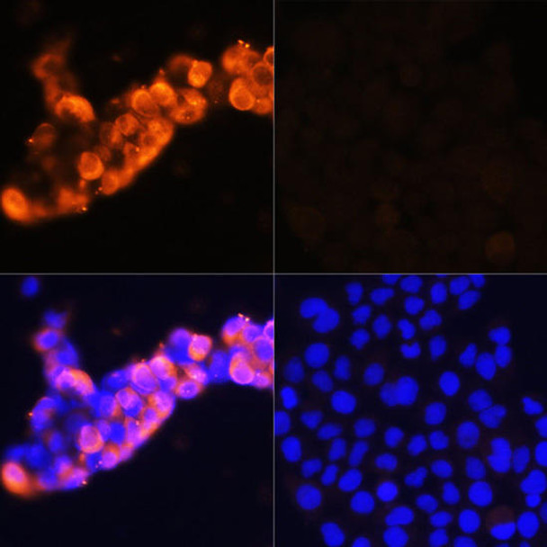 Cell Biology Antibodies 7 Anti-AFP Antibody CAB16750