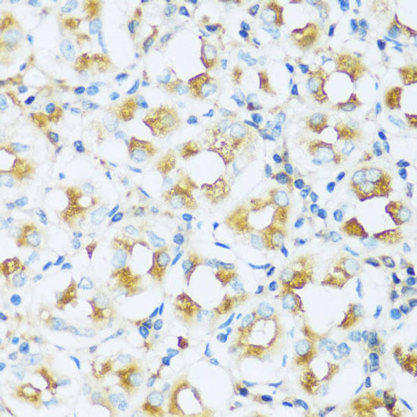 Signal Transduction Antibodies 2 Anti-APOD Antibody CAB16757