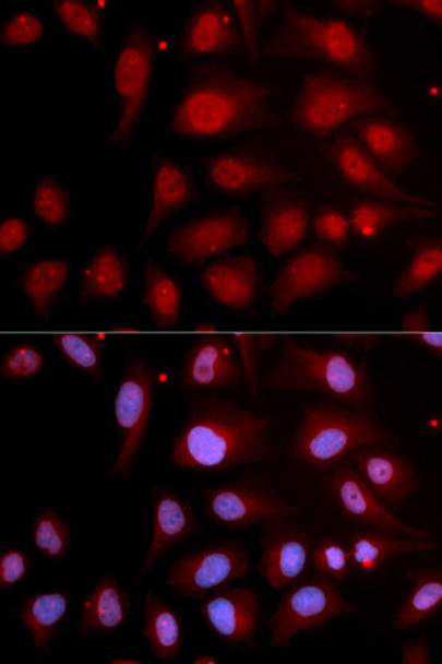 KO Validated Antibodies 1 Anti-POLB Antibody CAB1681KO Validated