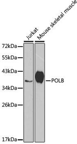 KO Validated Antibodies 1 Anti-POLB Antibody CAB1681KO Validated