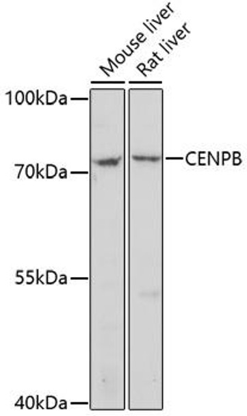 Epigenetics and Nuclear Signaling Antibodies 3 Anti-CENPB Antibody CAB16817