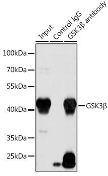 Cell Biology Antibodies 7 Anti-GSK3Beta Antibody CAB16868