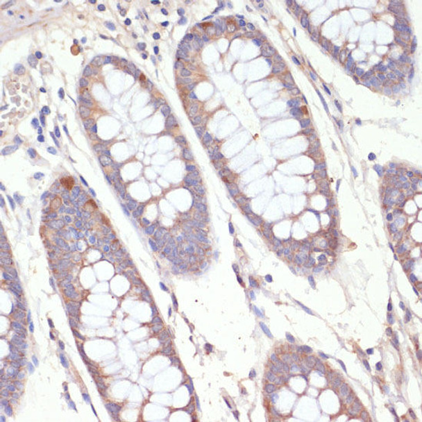 Metabolism Antibodies 2 Anti-HMGCR Antibody CAB16875