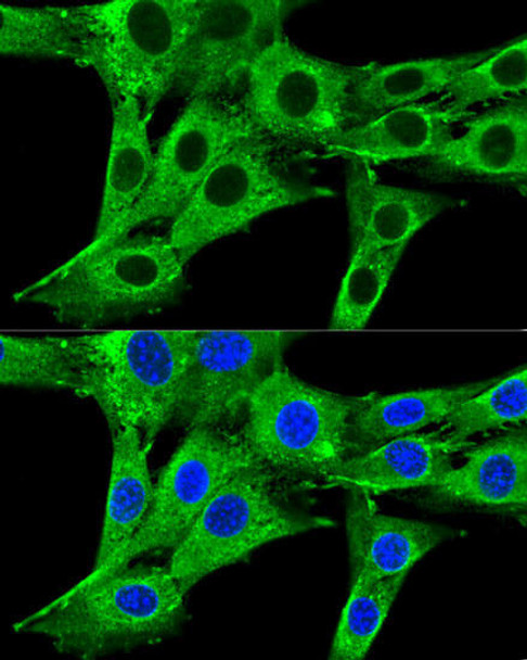 Metabolism Antibodies 2 Anti-HMGCR Antibody CAB16875