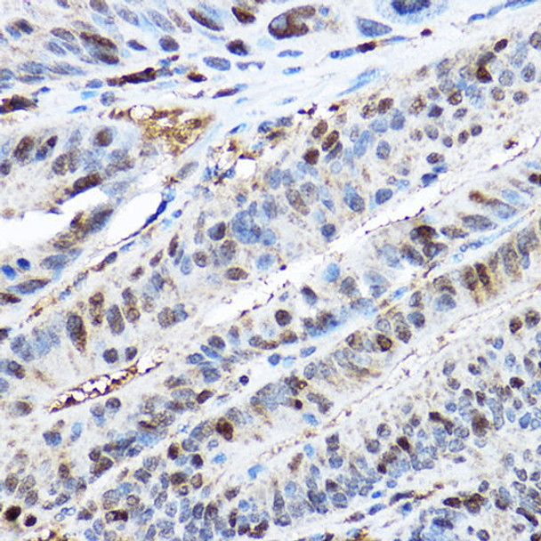 Cell Cycle Antibodies 1 Anti-CDK2 Antibody CAB16885