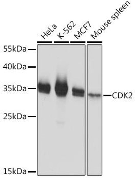 Cell Cycle Antibodies 1 Anti-CDK2 Antibody CAB16885